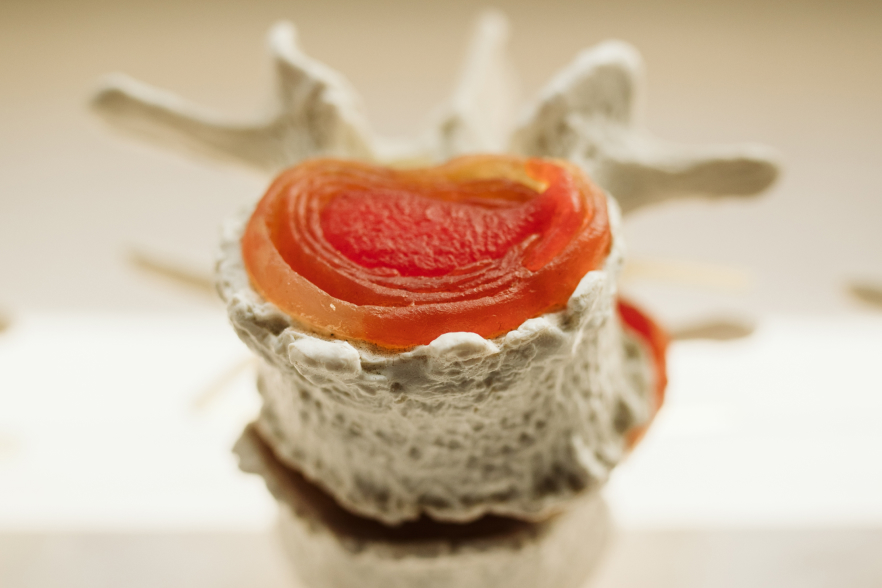 Neck Pain Wetherby Chiropractic