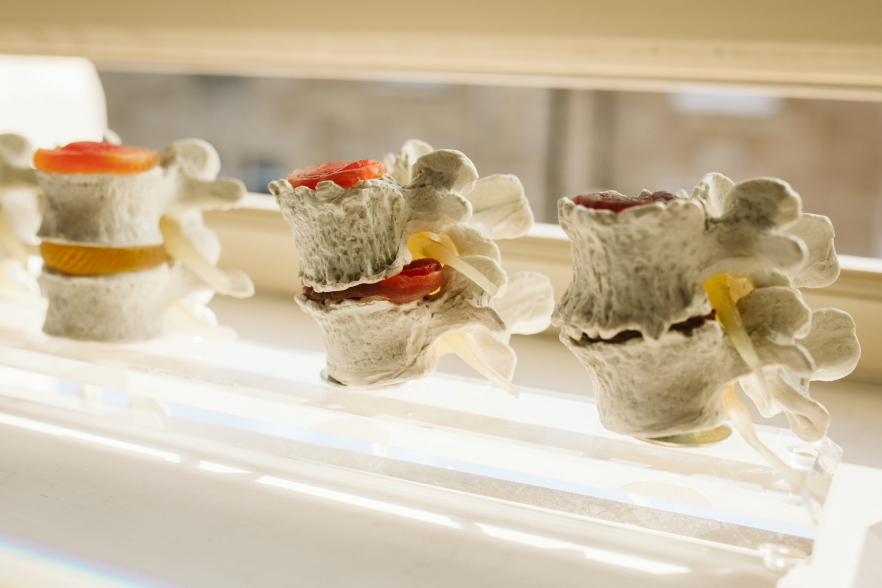 Neck Pain Wetherby Chiropractic